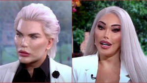 Je hotovo, KONČÍ! Niekdajší Ken, dnes už Barbie šokuje vyjadrením o svojom vzhľade!