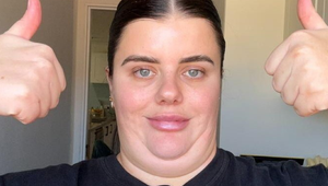 Neznášala svoju dvojitú bradu: Takto sa jej zbavila a dnes je z nej iná žena!