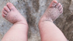Ako sa zbaviť piesku nalepeného na nohách? Tento trik funguje aj bez použitia vody
