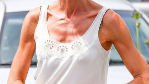 Z krásky chodiaca kostra! Neľahký osud sa na herečke podpísal