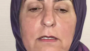 Chirurg sa pochválil premenou unavenej staršej ženy, ľudia sú v šoku: Nespozná ju ani vlastná rodina!