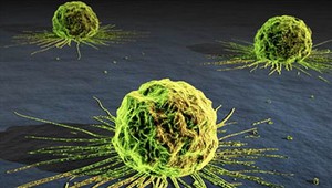 Zastaviť rakovinu môžeme skôr, ako vznikne, tvrdí slovenský odborník