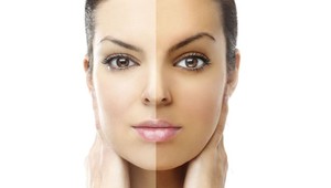 10 dôvodov, prečo mať radšej bledú, ale zdravú pokožku