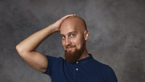 Chlapi, pozor! Vašej plešine teraz pomôže umelá inteligencia