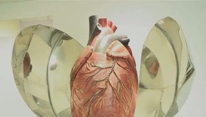 Choroby srdca zabíjajú. Toto je šesť varovných príznakov