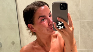 Žena prišla pre rakovinu o obe prsia: Neuveríte, čo urobila!