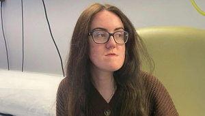 Celý život ju trápil obrovský predkus: Ženu po operácii NESPOZNÁTE!