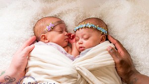 Rodičom sa narodili výnimočné dvojčatá: Šanca, že sa TO stane, je 1:10-miliónom
