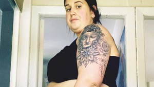 Po tehotenstve a schudnutí jej zostalo množstvo prebytočnej kože: Brutálna premena!