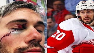 Hrôza v NHL! Drew Miller z Detroitu takmer prišiel o pravé oko