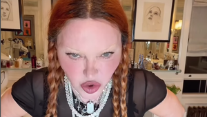 Čo to so sebou spravila?! Odborník prezradil, prečo vyzerá Madonna ako vosková figurína!