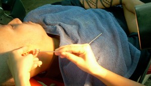 Svrbia vás často uši? Toto je 6 najčastejších dôvodov