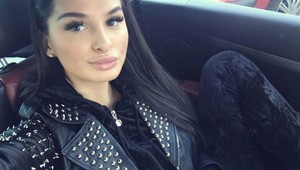 Plačková zavěsila na internet video ze zákroku: Co na sobě vylepšovala tentokrát?