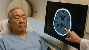 Demencia v Číne: Prípady raketovo stúpajú, vedci hľadajú príčiny