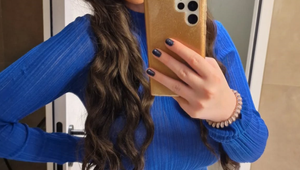 Na tvár sa jej radšej nepozerajte: Andrea ich chce stále väčšie!