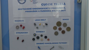 Prehltnuté batérie či vdýchnutie častí hračiek: Na čo si dať na sviatky u detí pozor?