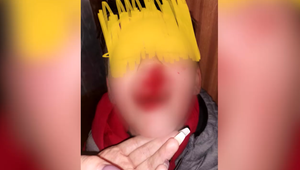 Polícia pátra po vodičovi, ktorý zrazil 8-ročného chlapca a ušiel