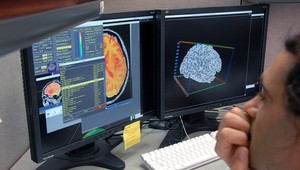 Nezanedbávajte príznaky mozgovej príhody