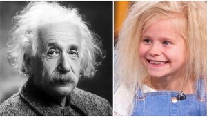 Výnimočnosť alebo pohroma? Dievčatko má na hlave výbuch ako Einstein