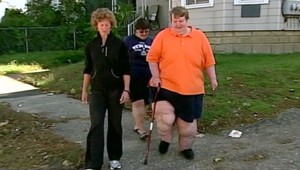 Za rok schudol neuveriteľných 150 kíl. Stále však váži 215!