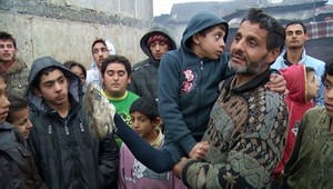 Kuriózne! Rómskemu chlapcovi sa nohy ohýbajú opačne