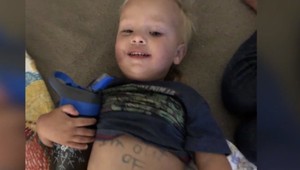 Detské jasle v problémoch. Učiteľka poslala odkaz matke priamo na tele jej dieťaťa