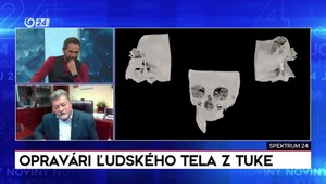 Spektrum 24 o opravároch ľudského tela z TUKE