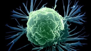 Experimentálna vakcína obracia rakovinové bunky proti sebe