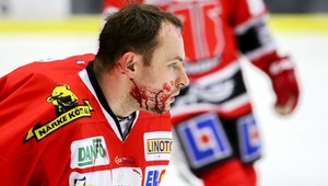 Tvár brankára Hudáčka porezal korčuľou spoluhráč z Örebra