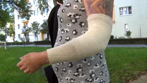 Tehotnú ženu napadol pes: Bola na prechádzke s malou dcérou