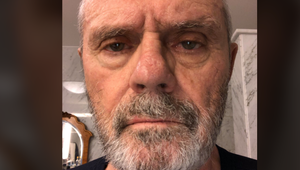 Covid-19 zmenil Milana Kňažka na nepoznanie! Silný odkaz lekárom!