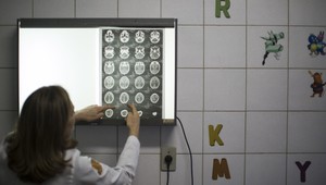 Vírus Zika môže spôsobovať vzácne neurologické ochorenie