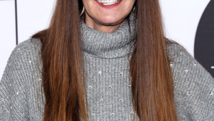 Pohľad na tvár bývalej topmodelky ľudí desí: Tie plastiky by si mala ľutovať!