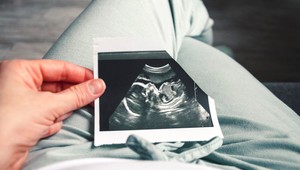 Interrupcie sú ďalším sporom v koalícii. Za ľudí hovoria o porušení koaličnej zmluvy