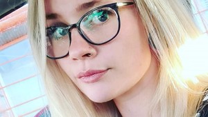 Ženy, dajte si pozor na túto farbu na vlasy: Krásnej blondíne spálila pokožku na hlave!