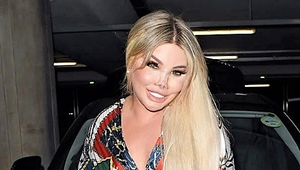 Ken alias Barbie podstúpila už dvanástu operáciu nosa! Výsledok je desivý!