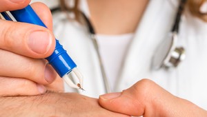 Očkovať proti kliešťovej encefalitíde sa môžete aj počas letnej sezóny