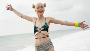 Chcela byť vyššia, tak jej predĺžili nohy o 14 centimetrov!