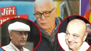 Jiří Bartoška (67): Ako prebieha liečba rakoviny, ako dlho bude trvať?