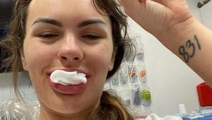 Kvôli závislosti prišla o všetky zuby, dnes sa konečne usmieva: Takto speváčku zmenil nový chrup