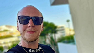 Máte bledú pleť a budete dlhšie na slniečku? Pozor, aby ste nedopadli ako Štěpán Kozub!