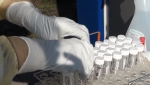 Viacerí zamestnanci žilinskej nemocnice ostali v karanténe. Jednému vyšiel test pozitívne