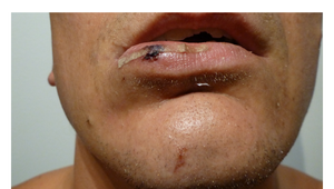 Inšpekcia vyšetruje brutálny zákrok policajta na onkologického pacienta