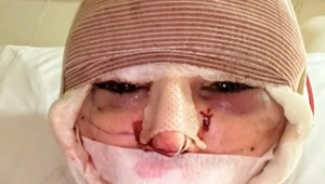 Podstúpila vyše 40 operácií, aby vyzerala ako Kardashianka: Neuveríte, po čom túži teraz!