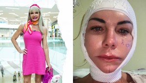 Dôverovala lekárke, zaplatila TVÁROU: Šokujúca spoveď Moniky Nemčokovej z Maniačok!