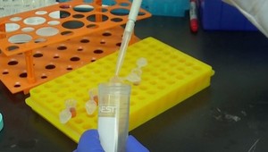 Výskumníci z celého sveta sa pustili do vývoja vakcín a liekov proti koronavírusu. Kedy budú dostupné?