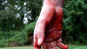 Pri páde si prerezal biceps