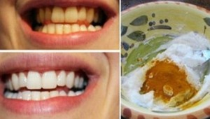 TOP domáca pasta na zuby: Vybieli chrup bez poškodenia, odstráni zlý dych aj zápal