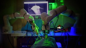 Robot vykonal prvú laparoskopickú operáciu na svete bez asistencie človeka