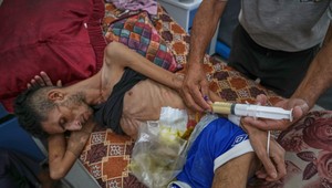 Gaza čelí zámernému hladomoru, varuje OSN. Počet podvyživených detí alarmujúco rastie